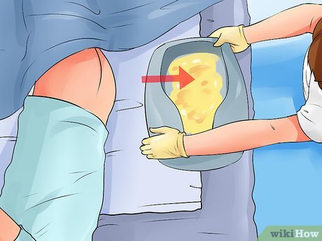 Best Way to Use Bed Pan